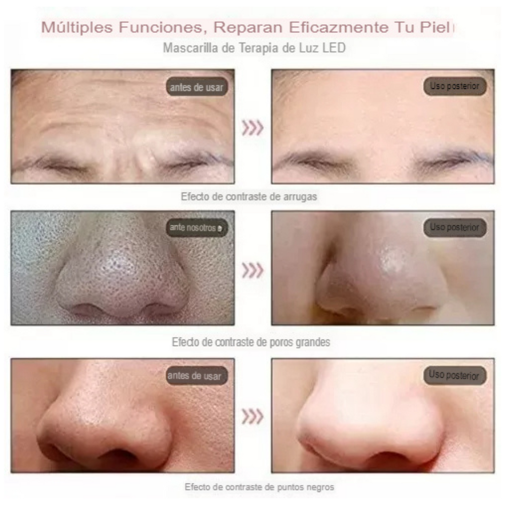 Máscara LED facial y cuello de 7 colores